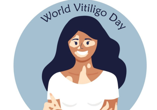 World Vitiligo Day Observed on 25 June 2025.